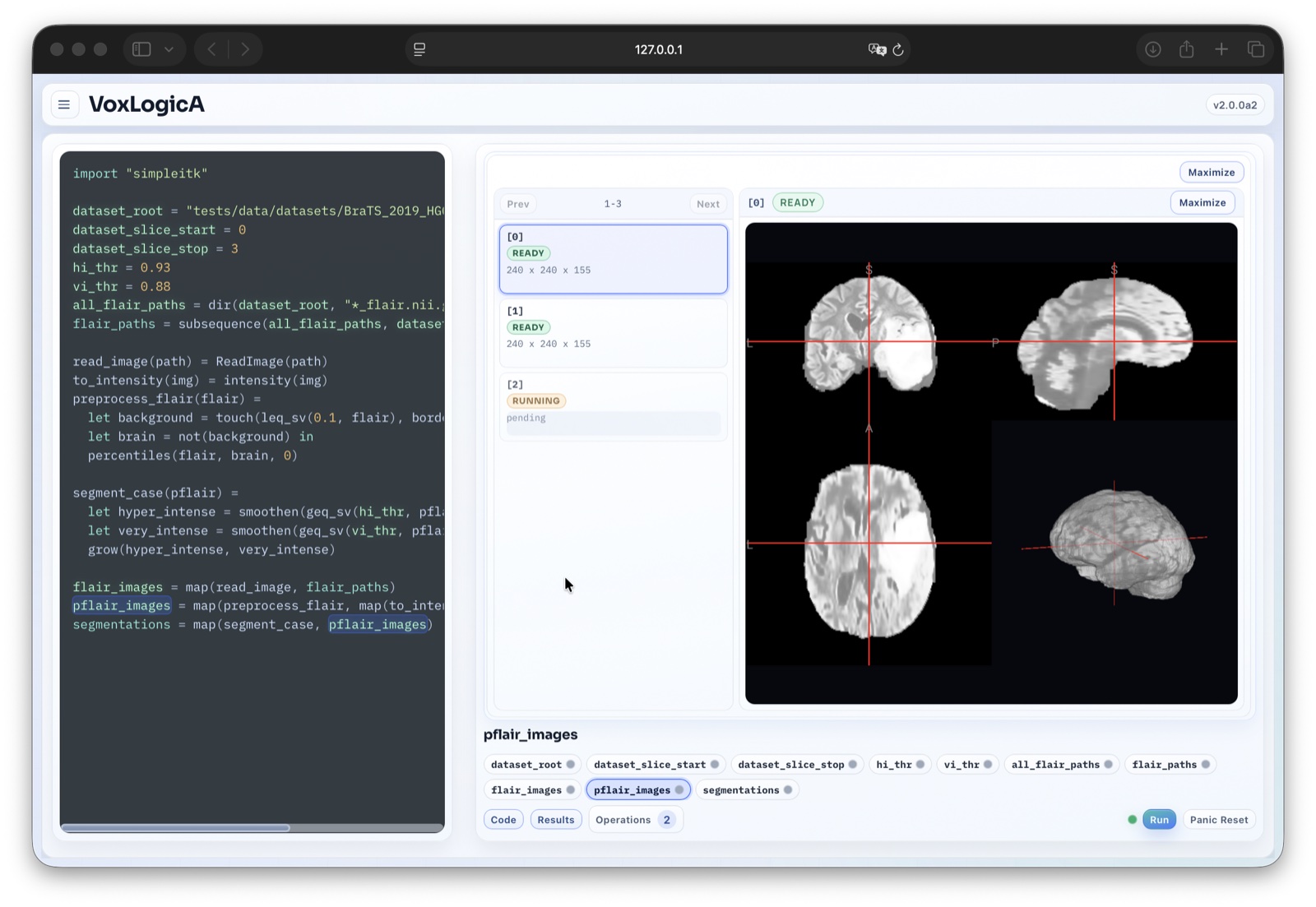 VoxLogicA 2: a script and the brain scans it segments